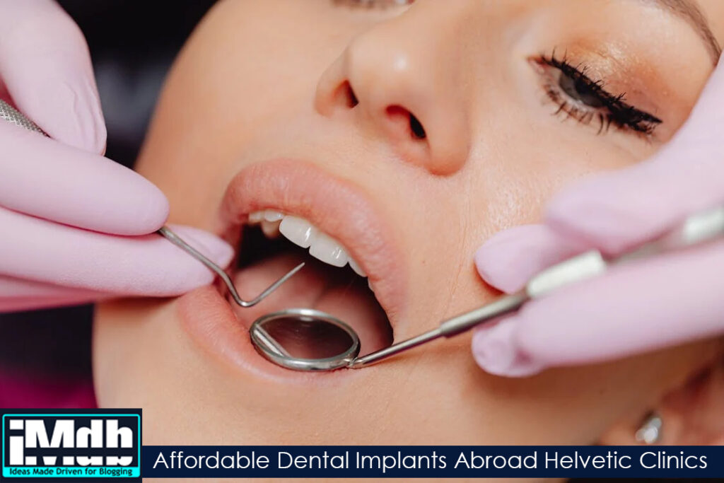 dental implants abroad helvetic clinics